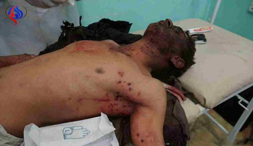 بالصور؛مجزرة للعدوان باستهداف سيارات أجرة قرب صنعاء