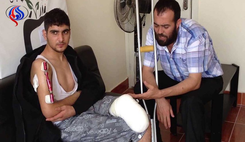 محارب سوري ربح “تل الزيارة” وخسر ساقه اليمنى