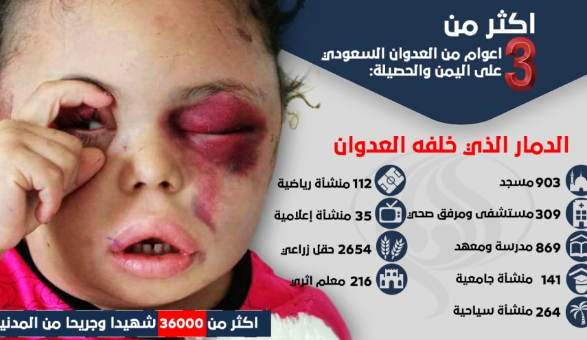 انفوجرافيك.. الدمار الذي خلفه العدوان السعودي على اليمن 