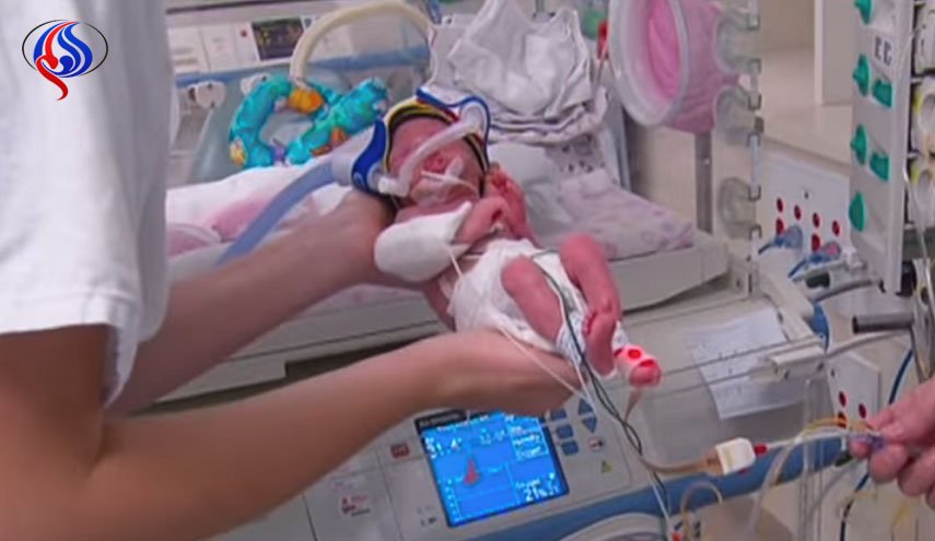 بالصور: معجزة طبية تمنح الحياة لرضيعة