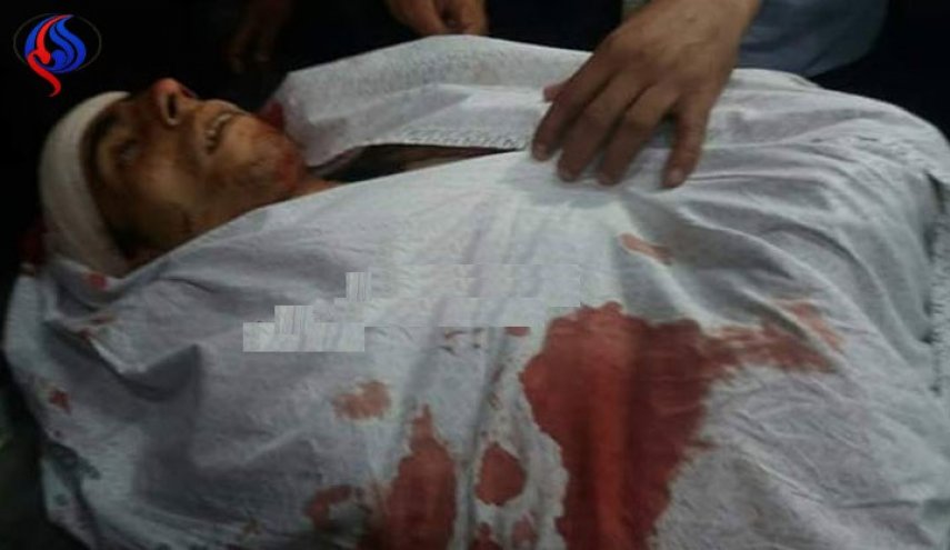 بالصور..3 شهداء ومئات الاصابات برصاص قوات الاحتلال 
