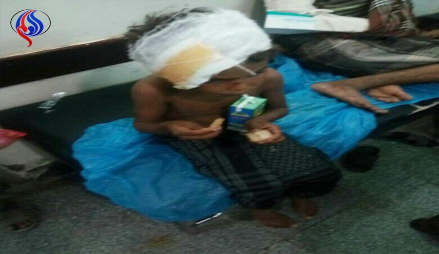زخمی شدن کودکان یمنی درحملات متجاوزان سعودی