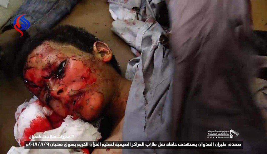 کودکان یمن قربانی وحشی‌گری محمد سعودی و محمد اماراتی!