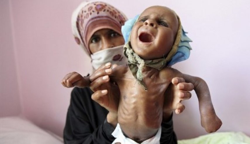 الوضع الإنساني في اليمن عشية بدء مفاوضات جنيف