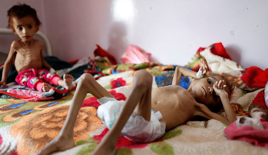 تحذير من فتك انعدام الأمن الغذائي باليمنيين بسبب حصار العدوان