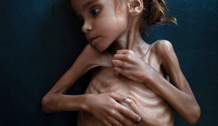 التايمز تختار صورة طفلة يمنية ضمن أهم 10 صور للعام 2018