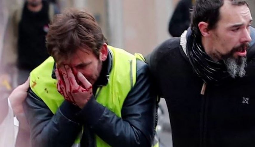 نماد تازه اعتراضات فرانسه؛ معترضانی که چشم خود را از دست داده‌اند