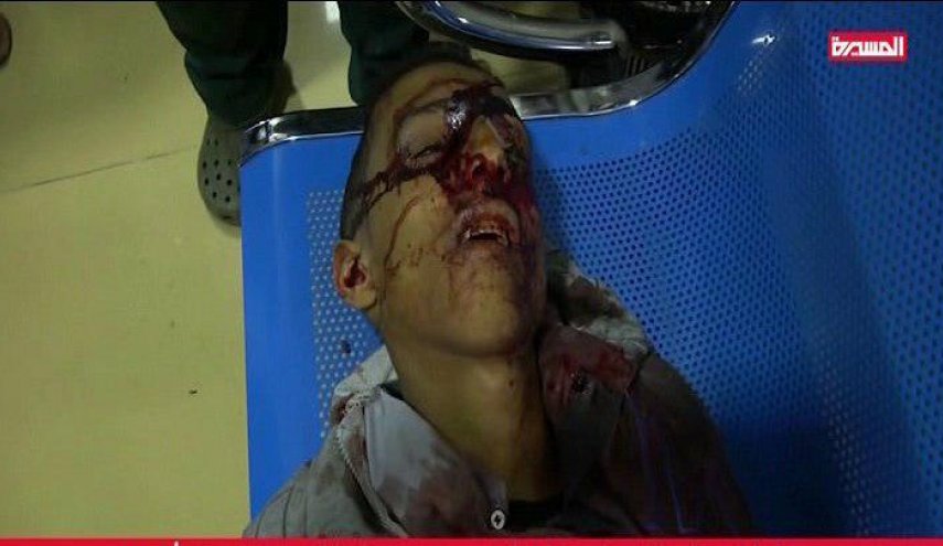 ارتفاع عدد ضحايا مجزرة جديدة في صنعاء الى 13 شهيدا و90 جريحاً 
