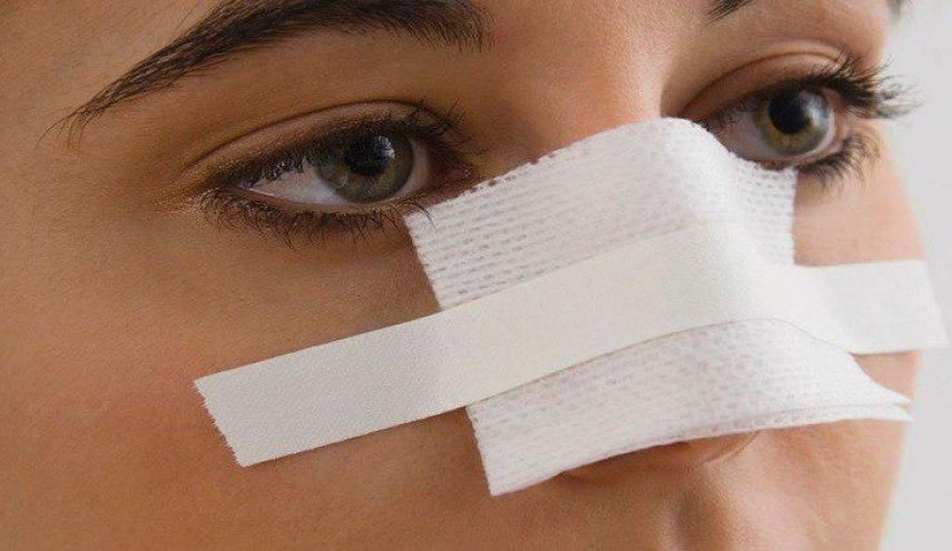 طريقة لتجميل الانف تحتاج 5 دقائق فقط دون جراحة