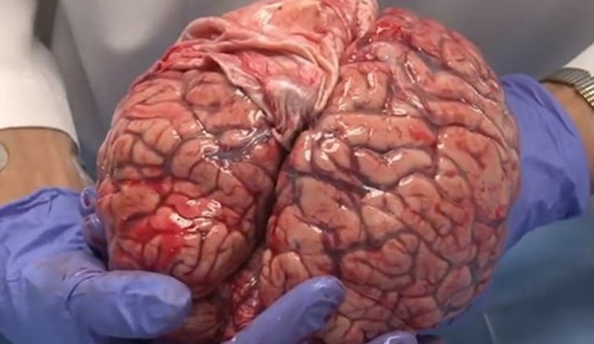 لأول مرة في إيران... مختصون يصنعون جهازاً طبياً لتحفيز للدماغ