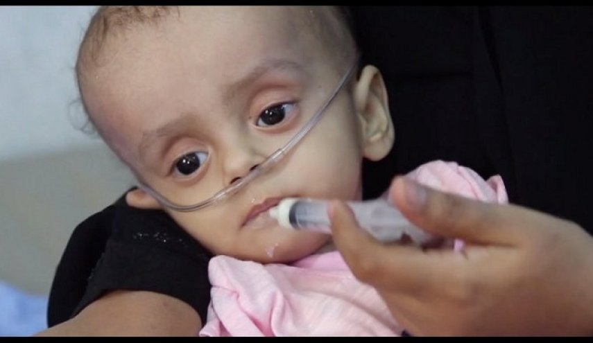 الصحة اليمنية: عدم توفر دعامات قلبية وصمامات لأكثر من 60 ألف مريض