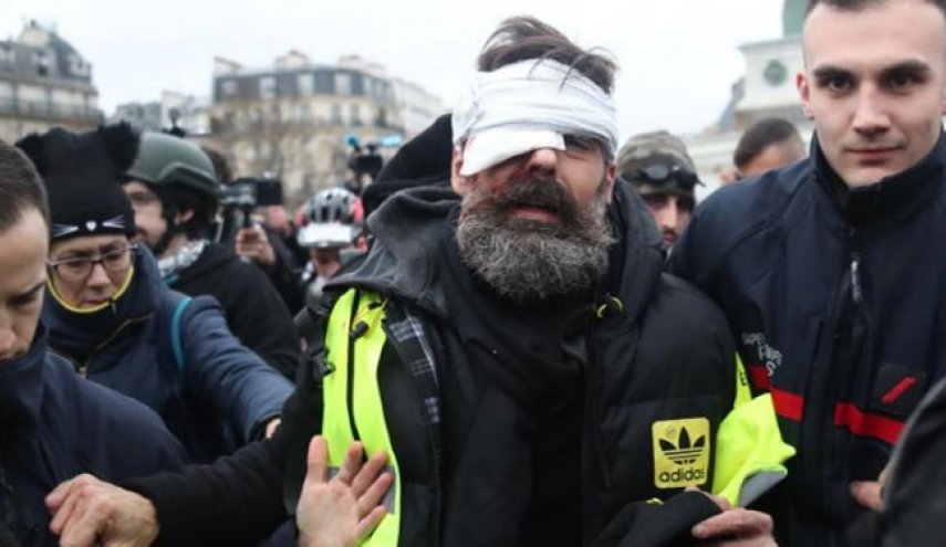 دستکم ۲۴ معترض فرانسوی از ناحیه چشم آسیب دیده‌اند
