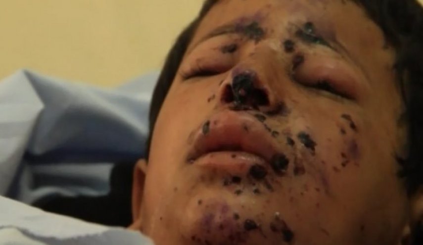 الجيش السعودي يقتل طفلا يمنيا في مديرية رازح الحدودية