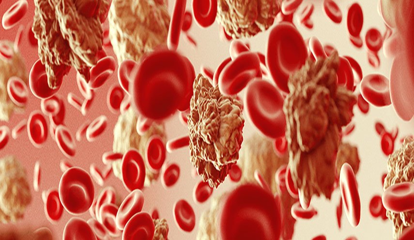 علاج جديد ينقذ المرضى من سرطان الدم الحاد 