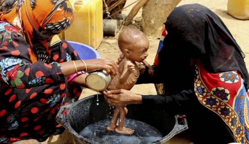 بسبب الحرب 79 % من سكان اليمن يعيشون تحت خط الفقر