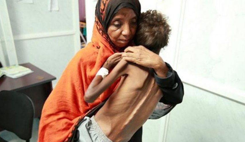 سازمان ملل: هر 11 دقیقه یک کودک در یمن جان می‌دهد