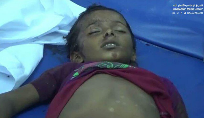 استشهاد 5 أطفال وإصابة سادس بانفجار قذيفة في الحديدة 