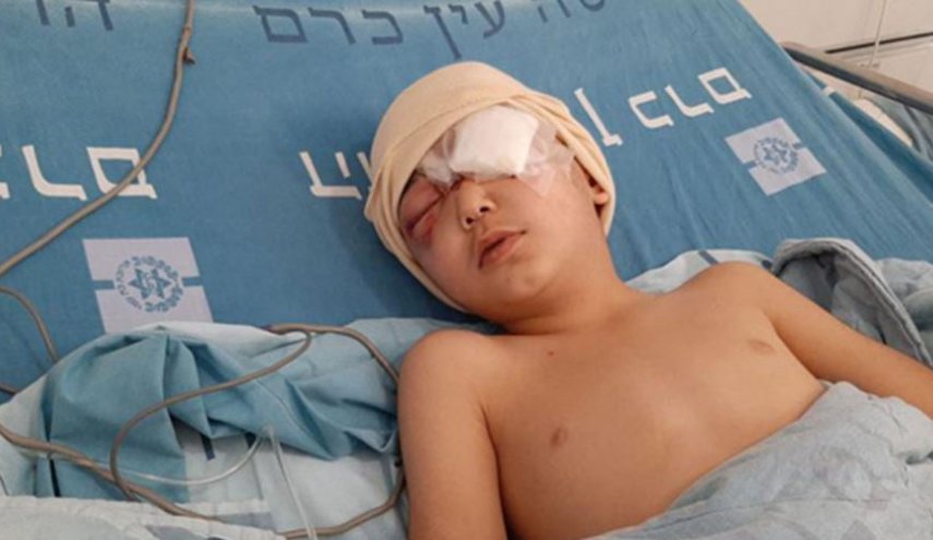 الطفل مالك عيسى لن يرى بعينه اليسرى بعد اليوم بفعل رصاصة إسرائيلية