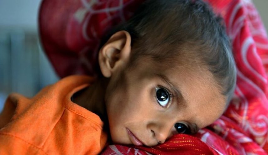یونیسف: 700 هزار کودک در افغانستان از سوءتغذیه شدید رنج می‌برند