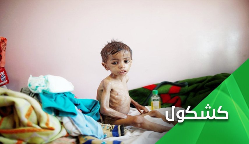 ائتلاف بن سلمان با کرونا برای قتل عام مردم یمن