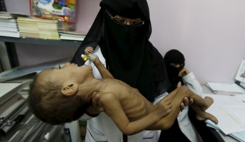 هر ۵ دقیقه یک کودک یمنی می‌میرد