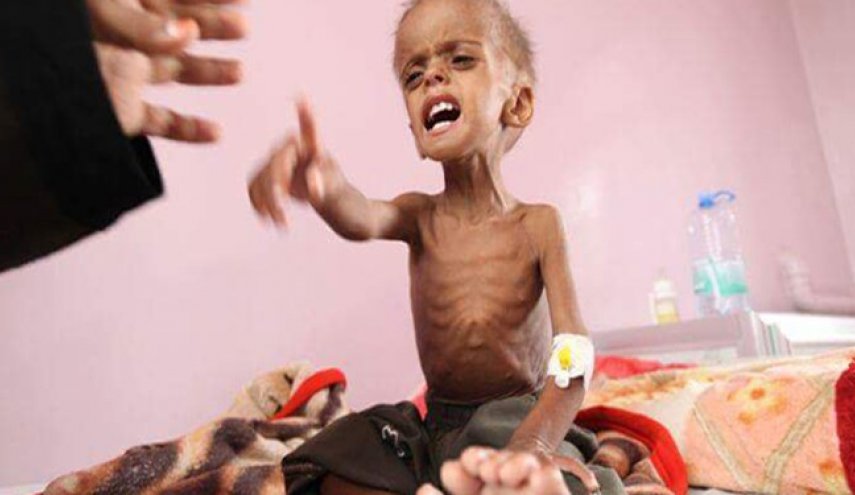 صنعاء: سازمان ملل دربرابر گرسنگی و کشتار میلیون‌ها کودک یمنی کور و کر است
