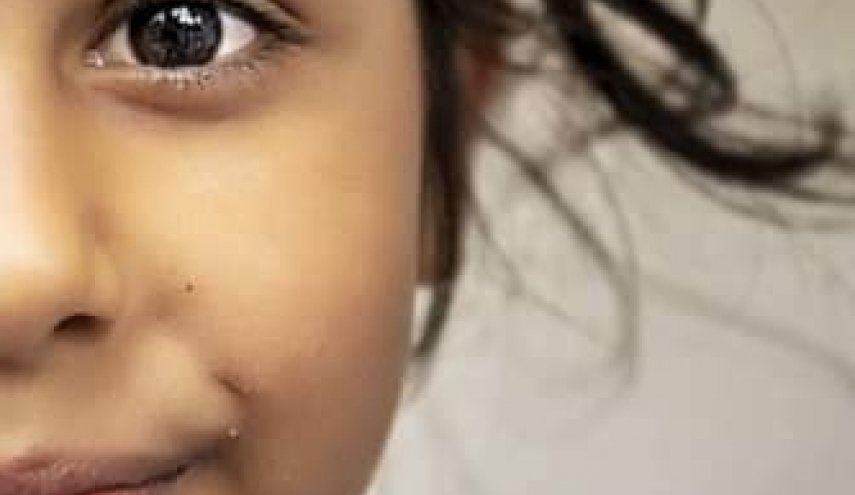 ظاهرة غريبة..​عينا طفلة سورية تشعل مواقع التواصل(شاهد)