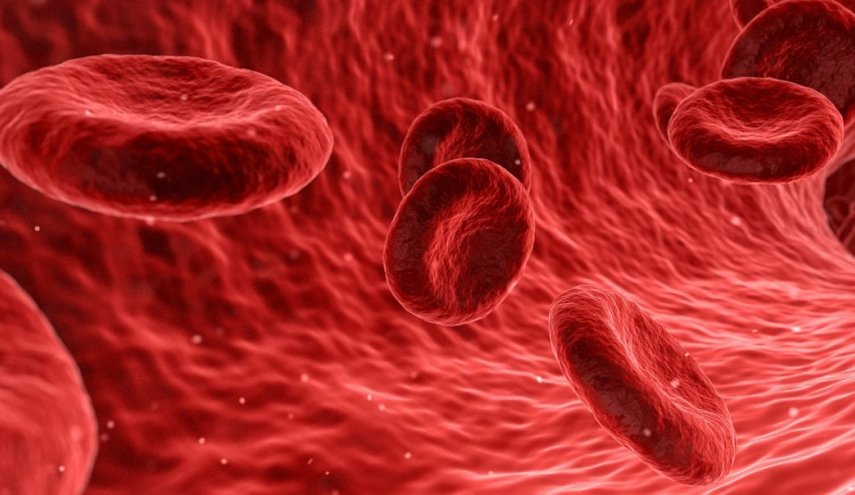 ما علاقة الأواني الحديدية بفقر الدم؟
