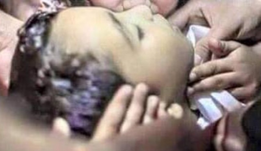 کشته و مجروحیت بیش از 13 هزار زن و کودک یمنی در پی حملات ائتلاف سعودی