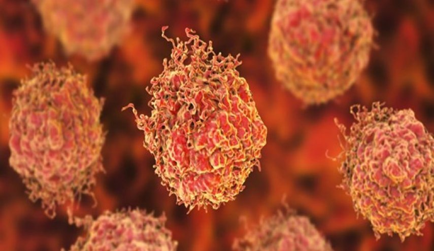 باحثة إيرانية تطور طريقة جديدة لعلاج السرطان