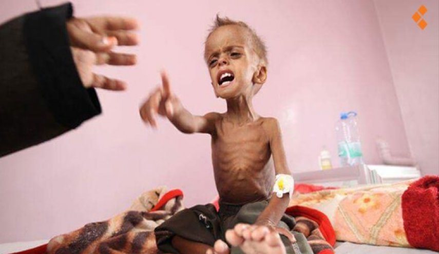 الصحة اليمنية:  السعودية تسببت في أكبر مأساة إنسانية لأطفال اليمن