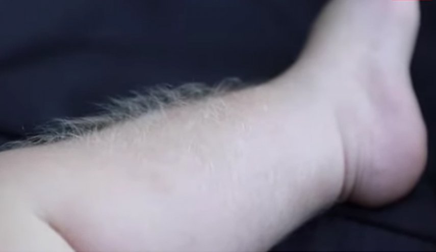 في كارثة نادرة.. 20 طفلا تحولوا إلى 