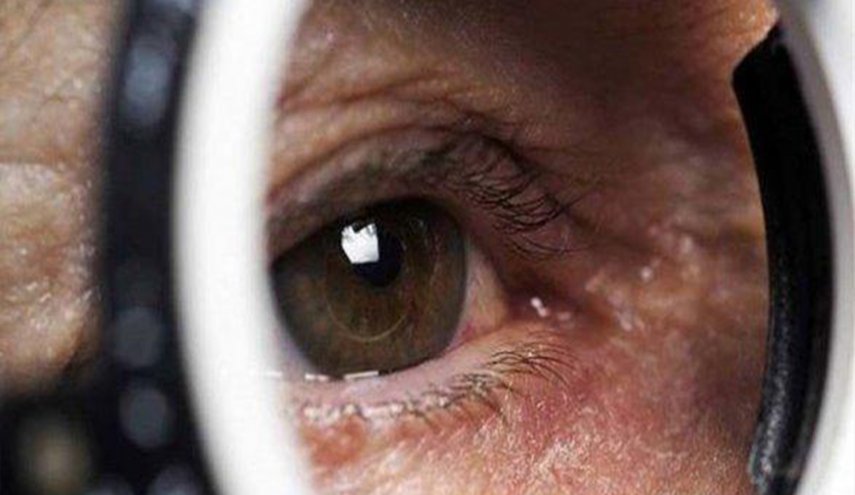  أعراض تصيب العين تكشف عن الإصابة بسرطان الرئة
