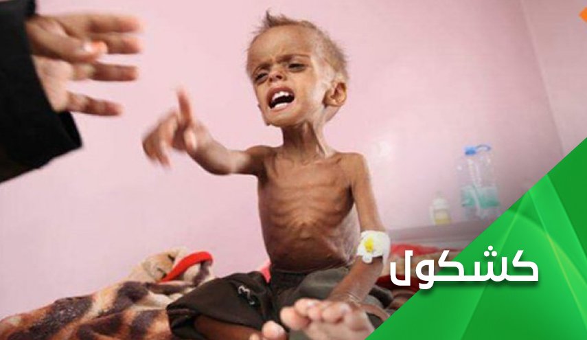 المجاعة اخر اسلحة المهزومون في اليمن 
