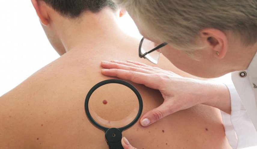 ابتكار جديد يساعد على مقاومة سرطان الجلد