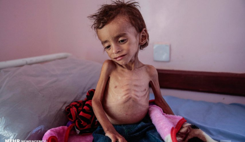 الأمم المتحدة: نحتاج 4 مليارات دولار خلال 2021 لتجنب مجاعة باليمن