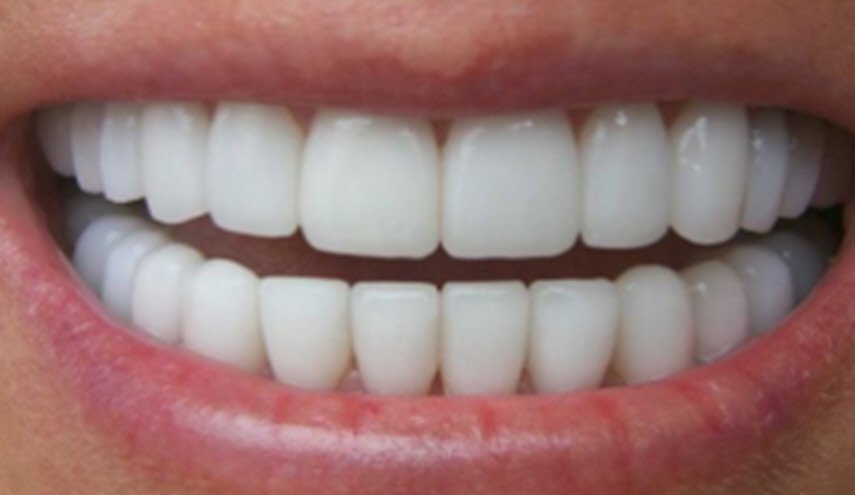 حيل مدهشة لحماية الأسنان من الاصفرار
