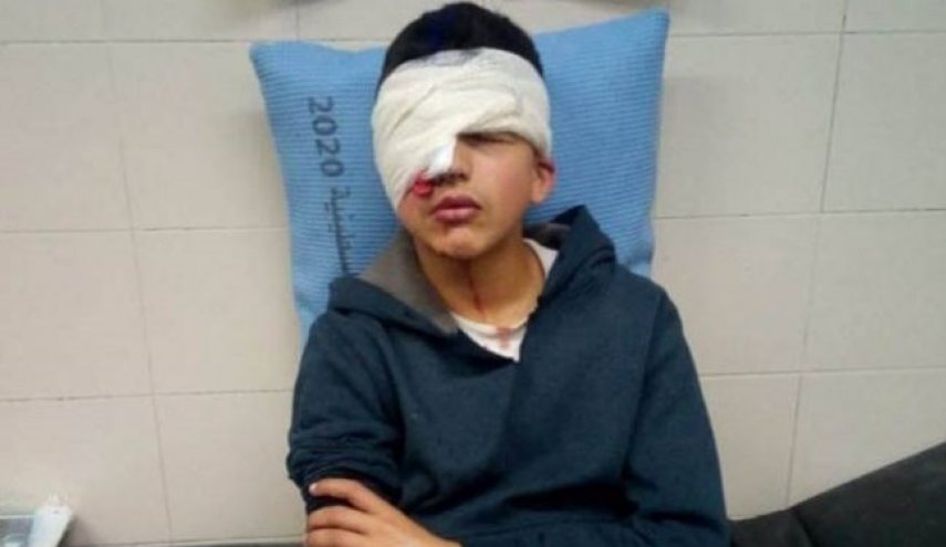 نوجوان فلسطینی به ضرب گلوله صهیونیست‌ها یک چشم خود را از دست داد+فیلم