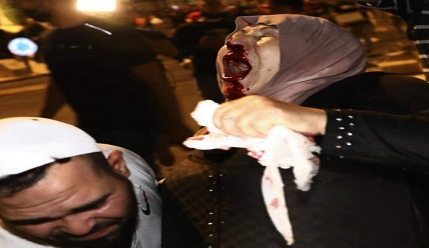 ارتفاع اصابات الفلسطينيين في القدس الى 90 اصابة