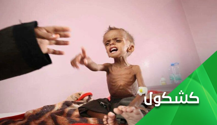 غوتيريش.. ومحاولة غسل يد إبن سلمان من دماء أطفال اليمن