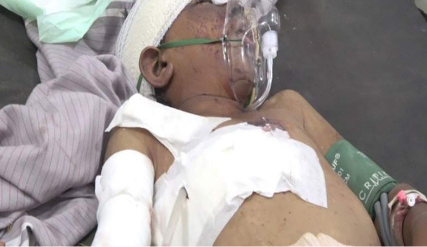 إصابة طفل بانفجار قنبلة عنقودية من مخلفات العدوان في حجة
