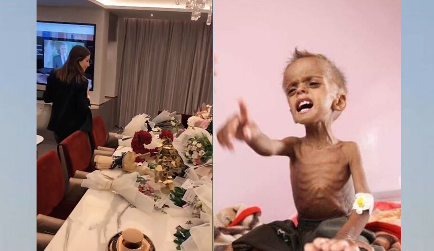 ناشطون يقارنون بين طفل يمني يموت جوعا وهدايا السعودية لنانسي!