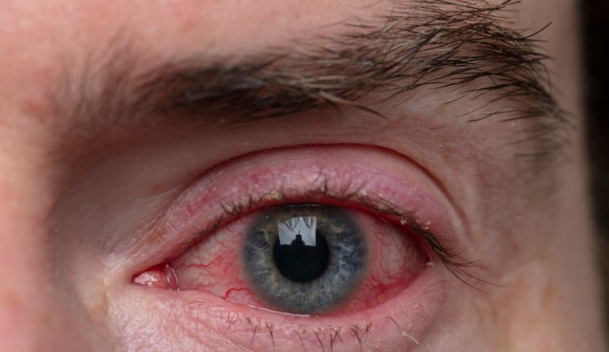 كيف يؤثر فيروس 'كوفيد-19' في جودة الرؤية
