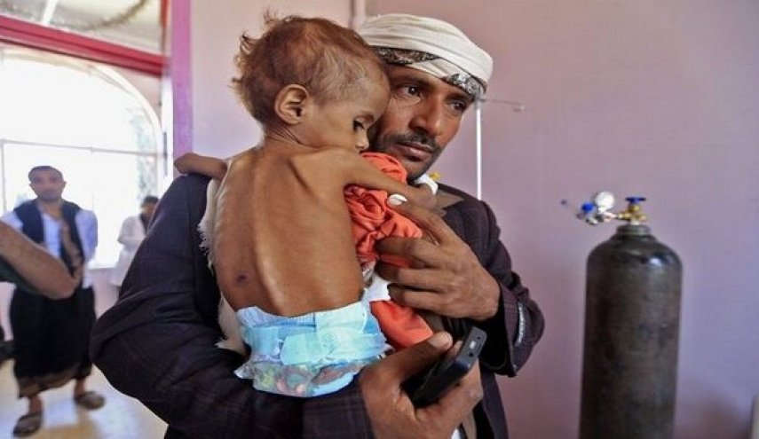 مرعب: طفل يمني يموت كل عشر دقائق نتيجة الجوع والأمراض