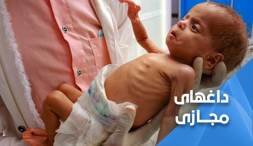 جنگ بایدن در یمن ادامه دارد؛ آمریکا در کشتار 400 هزار کودک یمنی دست دارد