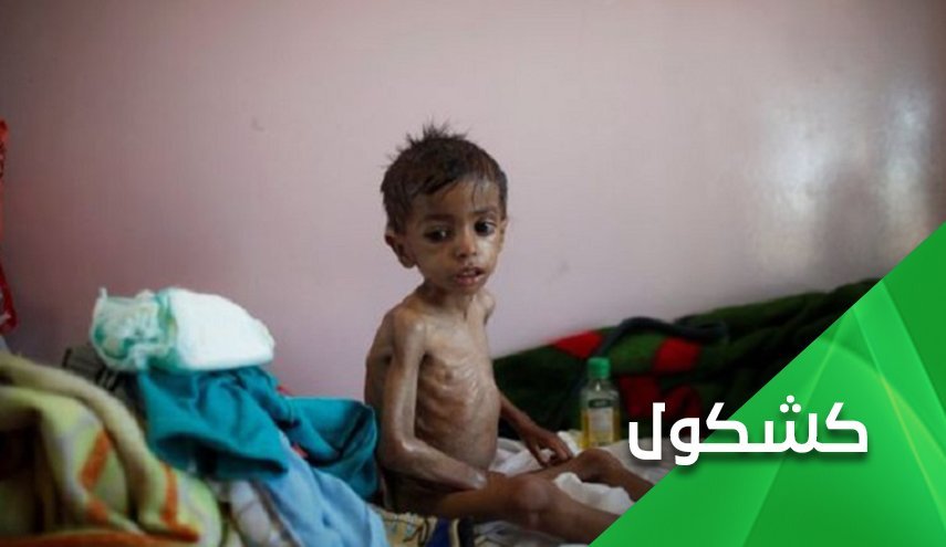 ریان مغربی از چاه نجات پیدا می کند اما کودکان یمن...