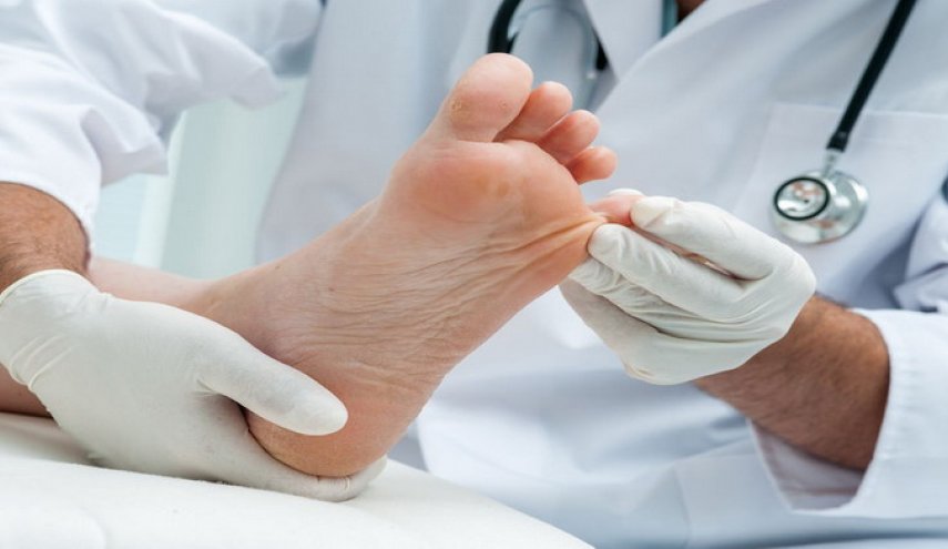 علامات تحذيرية على القدم تشير إلى الإصابة بمرض السكري