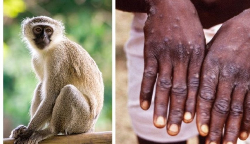 الصحة العالمية تعلن وفاة 58 شخصا بجدري القرود في دولة أفريقية

