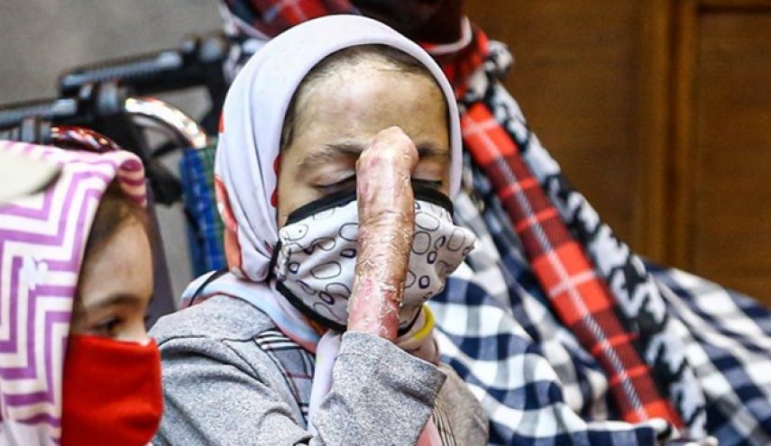 شركة سويدية تمتنع عن بيع ضمادات لاستخدامها لأطفال ايرانيين يعانون من مرض الفراشة