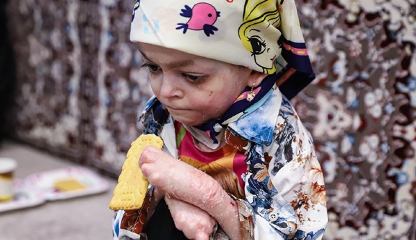 امتناع شرکت سوئدی از فروش پانسمان برای کودکان پروانه‌ای ایران